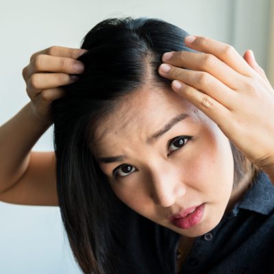 Sad,Asian,Girl,Looking,At,Her,Damaged,Hair,,Postpartum,Hair